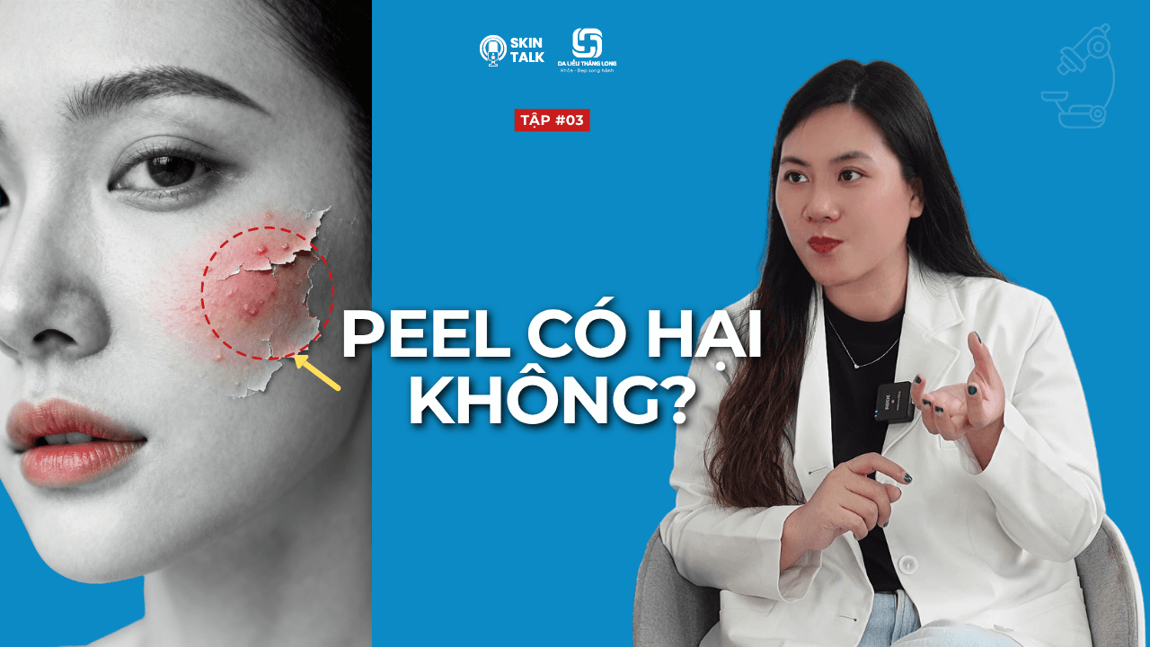 Có nên peel da không? Những điều bác sĩ khuyên bạn cần hiểu rõ