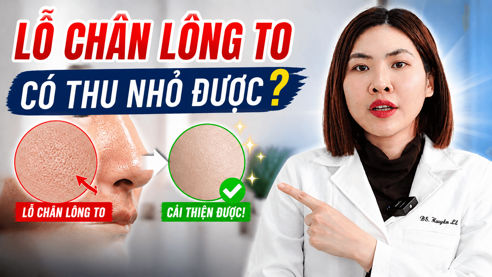 Lỗ chân lông to có thật sự thu nhỏ được không?