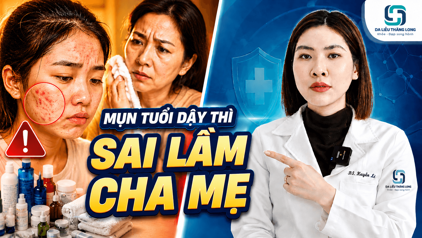 Mụn tuổi dậy thì: Cha mẹ nên hỗ trợ con như thế nào?