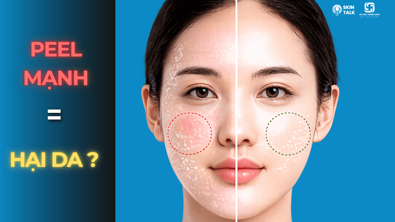 Peel da TCA có tốt không? Giải thích từ góc nhìn bác sĩ