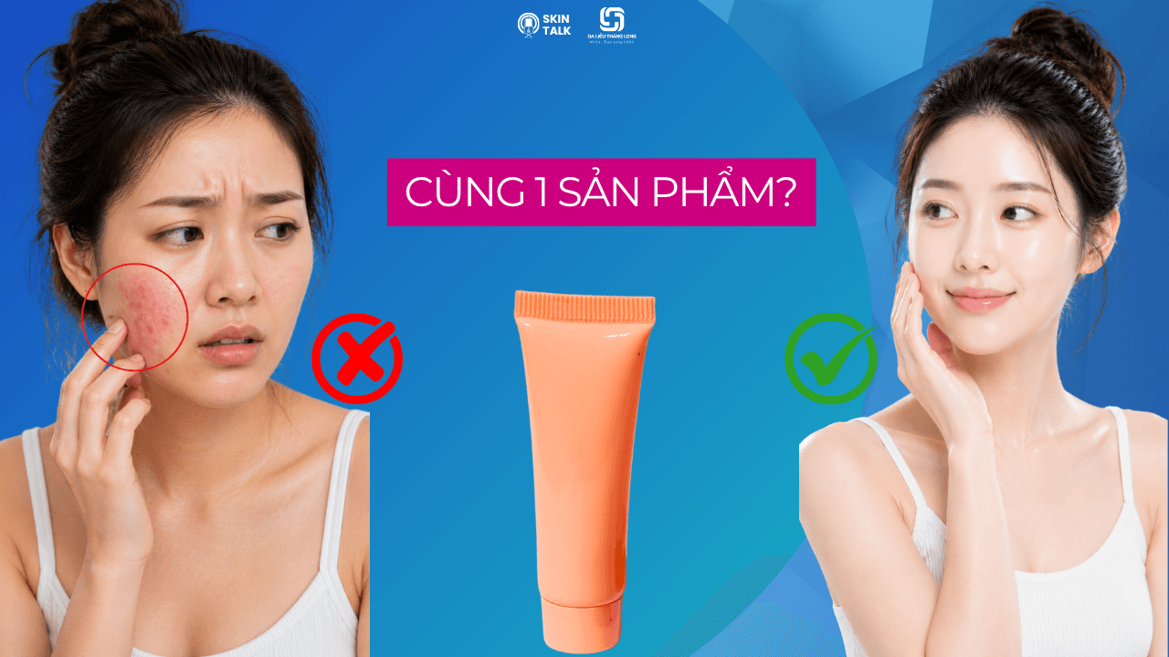 Vì sao cùng một sản phẩm, có người hợp có người lại kích ứng?