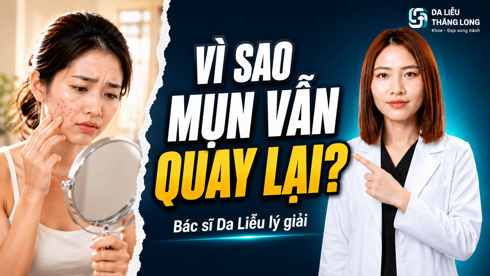 Vì sao mụn trứng cá dễ tái phát dù đã điều trị? Góc nhìn từ bác sĩ