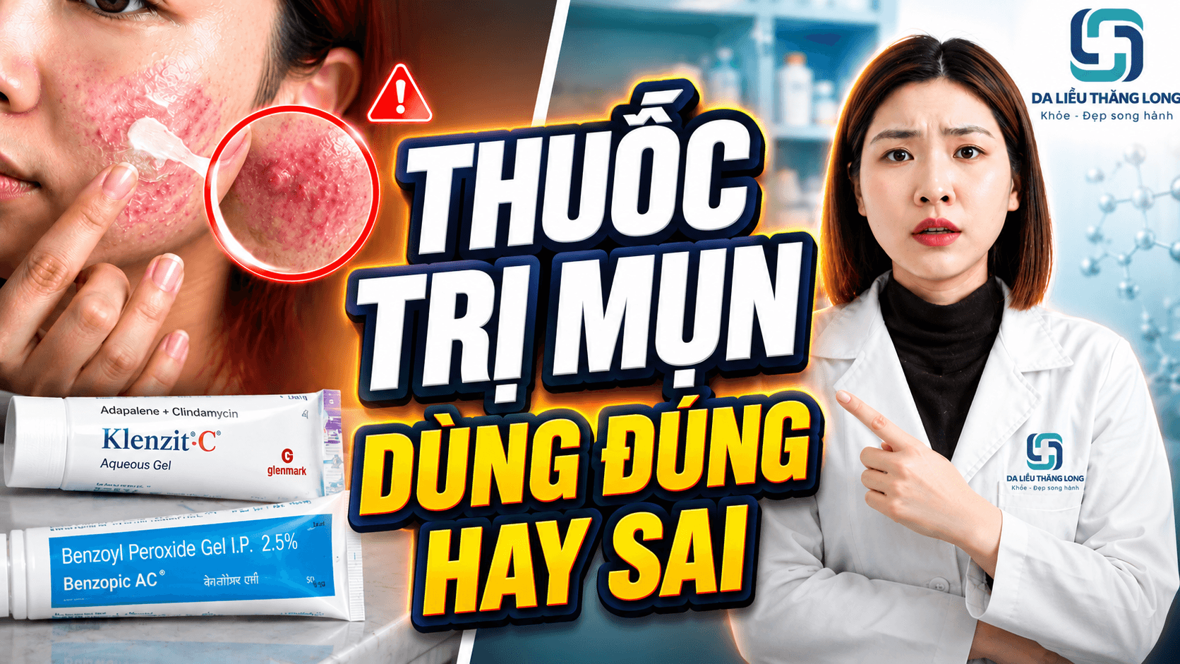 Những thuốc trị mụn phổ biến ở Việt Nam: dùng đúng hay sai?